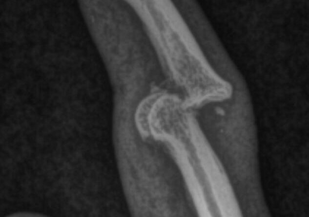 Fracturas y luxofracturas en la mano – Asociación Argentina de Cirugía de la Mano