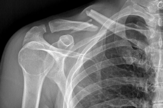 Curso de cirugía de la mano y miembro superior – Asociación Argentina de Cirugía de la Mano